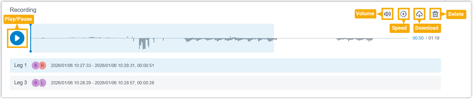The recording panel showing a call's audio as a single waveform across all legs